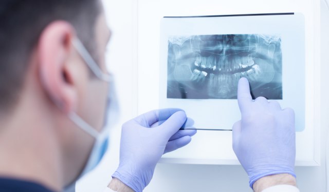 Stomatolog otkriva da li izvađeni zub može da se iskoristi